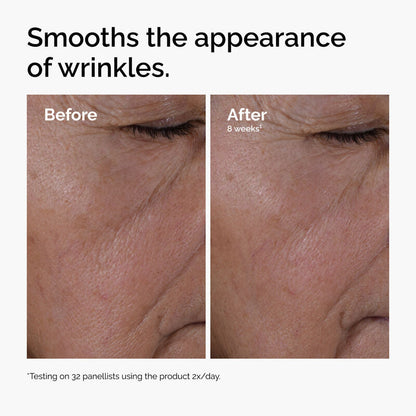 Multi-Peptide + HA Serum